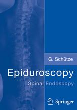 Epiduroscopy — Spinal Endoscopy