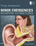 Minor Emergencies. Splinters to Fractures