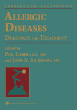 Allergic Diseases: Diagnosis and Treatment
