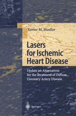 Lasers for Ischemic Heart Disease: Update on Alternatives for the Treatment of Diffuse Coronary Artery Disease