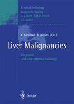 Liver Malignancies: Diagnostic and Interventional Radiology