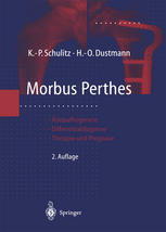 Morbus Perthes: Ätiopathogenese, Differentialdiagnose, Therapie und Prognose