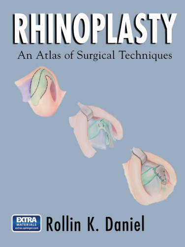 Rhinoplasty: An Atlas of Surgical Techniques