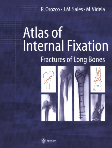 Atlas of Internal Fixation: Fractures of Long Bones. Classification, Statistical Analysis, Technique, Radiology