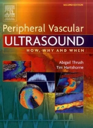 Peripheral Vascular Ultrasound How Why and When