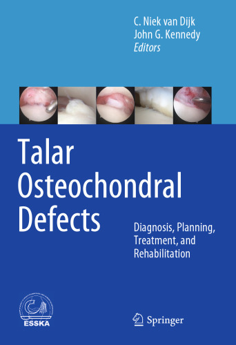 Talar Osteochondral Defects: Diagnosis, Planning, Treatment, and Rehabilitation