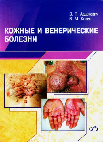Кожные и венерические болезни.