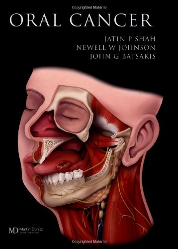 Oral Cancer