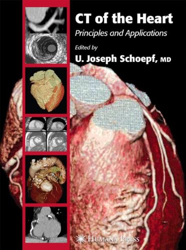 CT of the Heart Principles and Applications