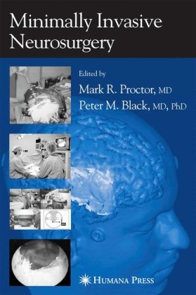 Minimal Invasive Neurosurgery