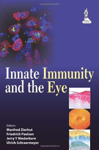 Innate Immunity and the Eye