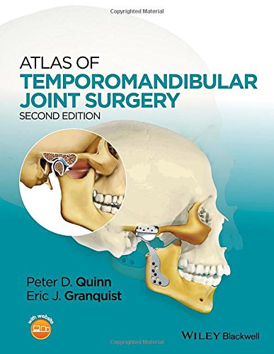 Atlas of Temporomandibular Joint Surgery