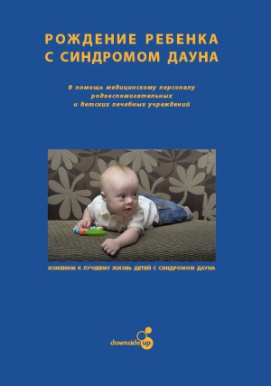 Рождение ребенка с синдромом Дауна
