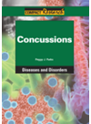 Concussions