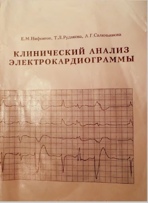 Клинический анализ электрокардиограммы