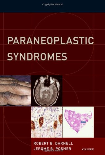 Paraneoplastic Syndromes