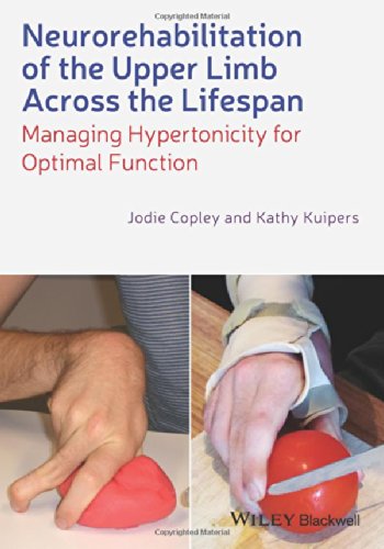 Neurorehabilitation of the Upper Limb Across the Lifespan: Managing Hypertonicity for Optimal Function