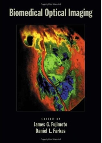 Biomedical optical imaging