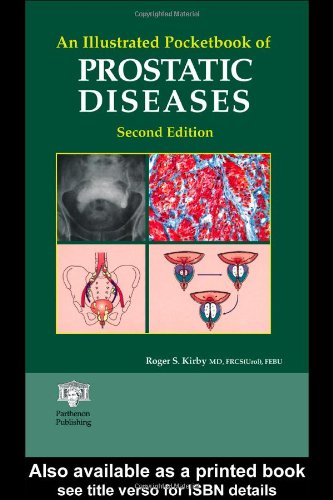 An illustrated pocketbook of prostatic diseases