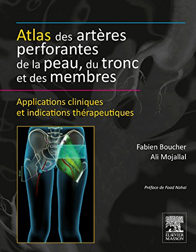 Atlas des artères perforantes de la peau, du tronc et des membres : applications cliniques et indications thérapeutiques