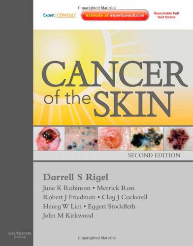 Cancer of the Skin: Expert Consult - Online and Print, 2e
