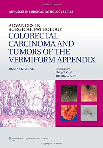 Advances in Surgical Pathology: Colorectal Carcinoma and Tumors of the Vermiform Appendix