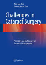 Challenges in Cataract Surgery: Principles and Techniques for Successful Management