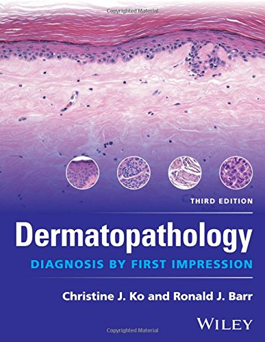 Dermatopathology: diagnosis by first impression