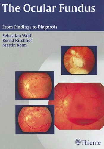 The Ocular Fundus: From Findings to Diagnosis