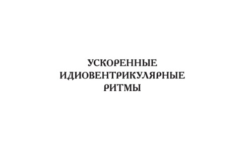 Ускоренные идиовентрикулярные ритмы