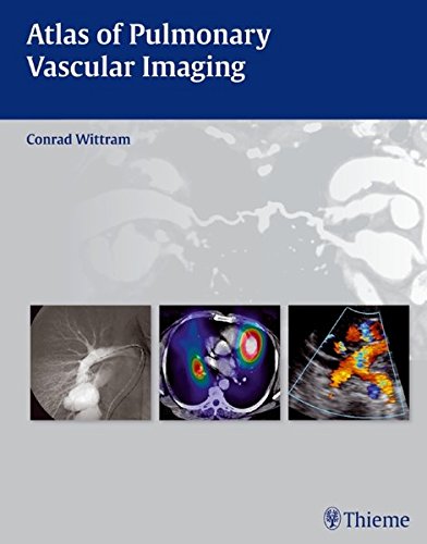 Atlas of pulmonary vascular imaging