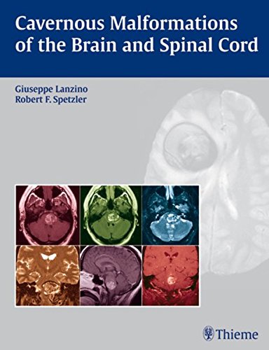 Cavernous malformations of the brain and spinal cord