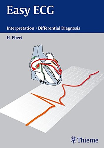 Easy EKG: interpretation, differential diagnoses