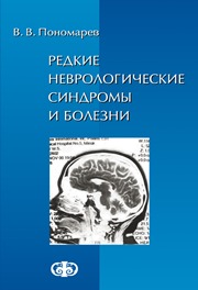 Редкие неврологические синдромы и болезни
