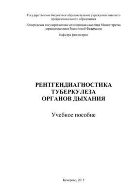 Рентгендиагностика туберкулеза органов