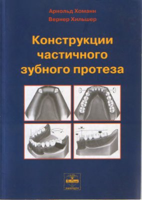 Конструкции частичного зубного протеза