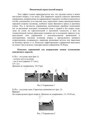 Поясничный лордоз. Комплекс упражнений
