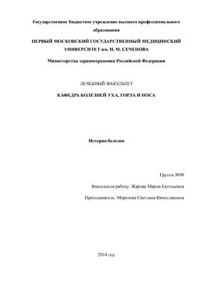 Перфорация левой барабанной перепонки