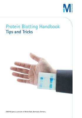 Protein blotting handbook. Tips and Tricks
