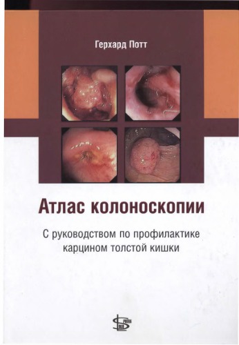 Атлас колоноскопии. ()(8 Mb)