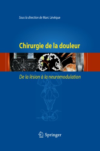Chirurgie de la douleur