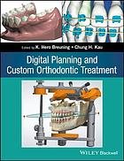 Digital planning and custom orthodontic treatment