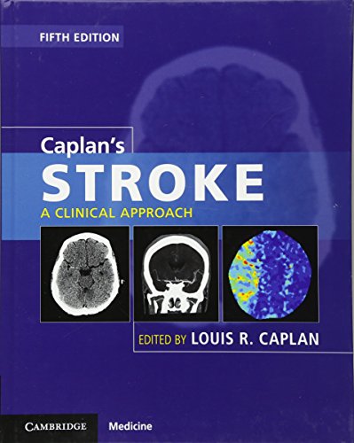 Caplan’s Stroke: A Clinical Approach