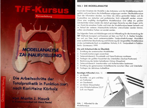 TiF-Kursus : Schulungsmaterial Modellanalyse, Zahnaufstellung ; die Arbeitsschritte der Totalprothetik in Funktion (TiF) nach Karl-Heinz Körholz