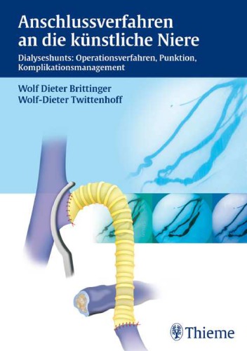 Anschlussverfahren an die künstliche Niere : Dialyseshunts: Operationsverfahren, Punktion, Komplikationsmanagement ; 10 Tab.