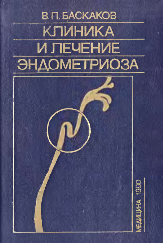 Клиника и лечение эндометриоза.