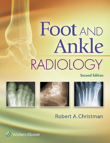 Foot and Ankle Radiology