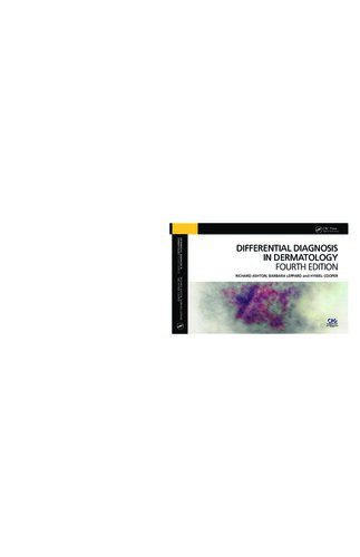 Differential Diagnosis in Dermatology