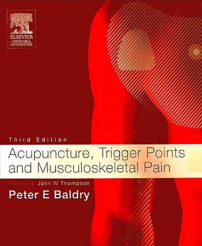 Acupuncture, Trigger Points and Musculoskeletal Pain (Acupuncture, Trigger Points, & Musculoskeletal Pain)