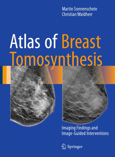 Atlas of Breast Tomosynthesis Imaging Findings and Image-Guided Interventions